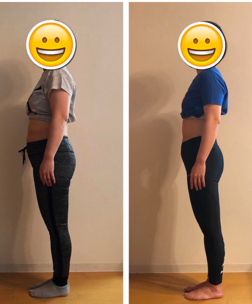女性のお客様のビフォーアフター写真（横向き）