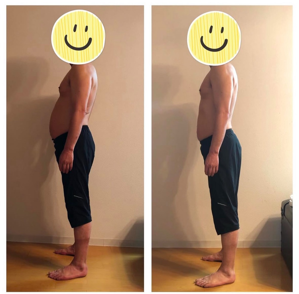 男性のお客様のビフォーアフター写真(横向き)