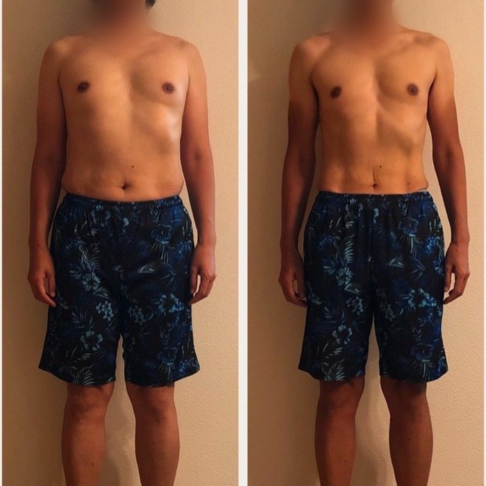 男性のお客様のビフォーアフター写真（正面）