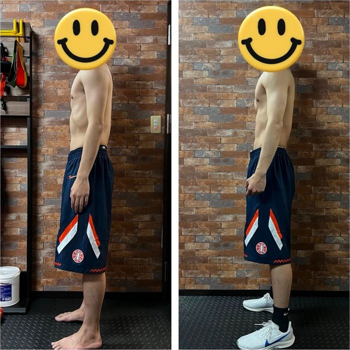 男性のお客様のビフォーアフター写真（横向き）