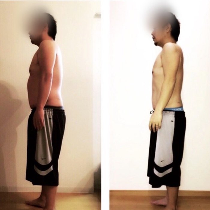 男性のお客様のビフォーアフター写真(横向き)